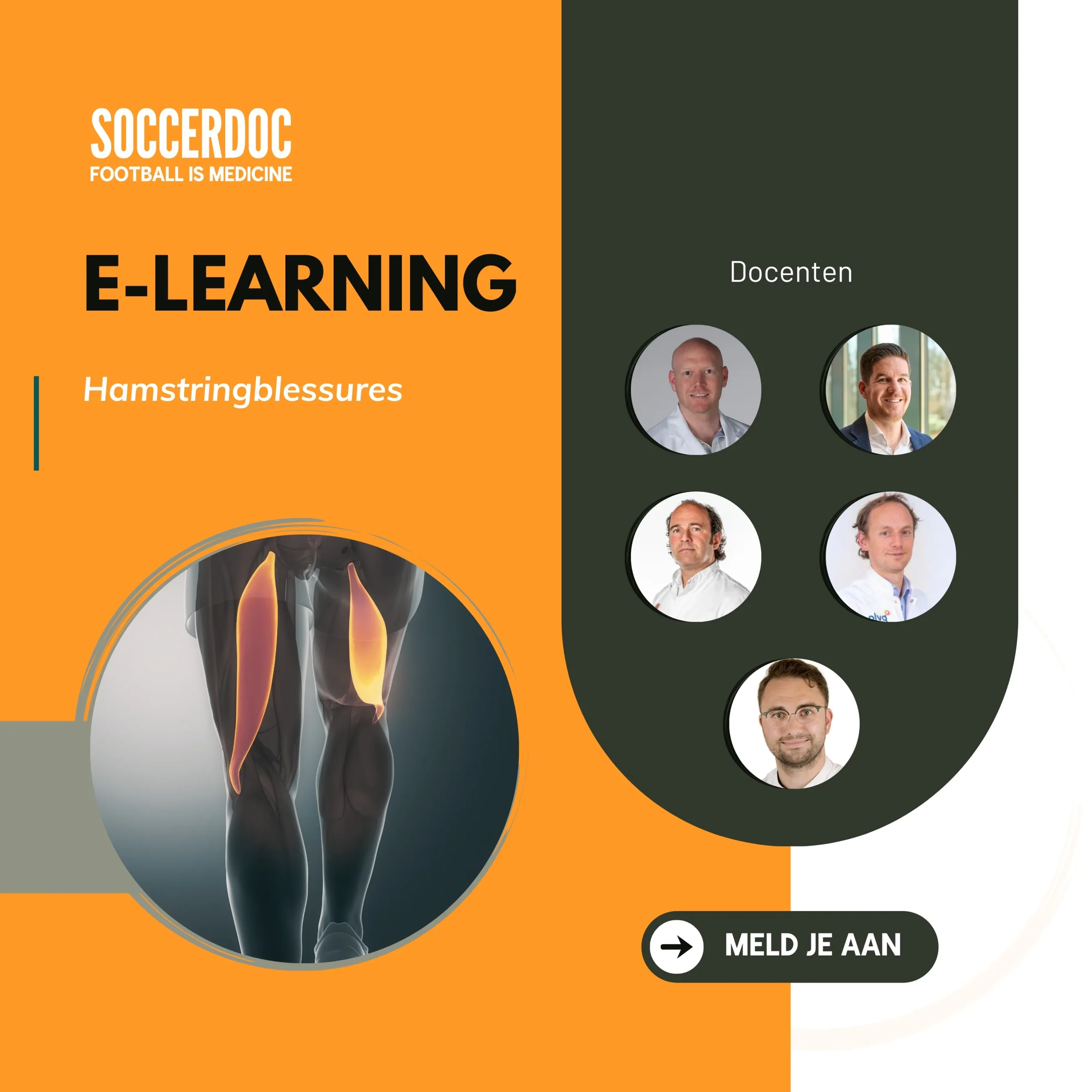e-learning Hamstringblessures SoccerDoc e-learning Hamstringblessures SoccerDoc
